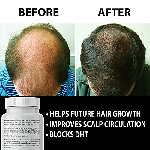 Finanutride Естествен блокер на DHT и капсули за растежа на косата, за да се предотврати загуба на коса, стимулиране на космените фоликули, спиране на косопад, растежа на н?